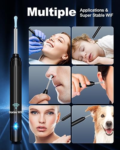 Ear Wax Removal Tool Camera with 6 LED Lights and 6 Ear Picks G936